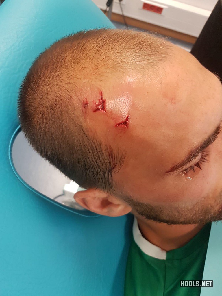 Sporting striker Bas Dost suffered a head wound in the attack